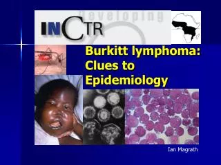 Burkitt lymphoma: Clues to Epidemiology