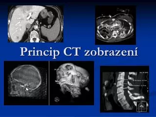 princip ct zobrazen