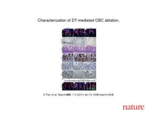 H Tian et al . Nature 000 , 1 - 5 (2011) doi:10.1038/nature10408