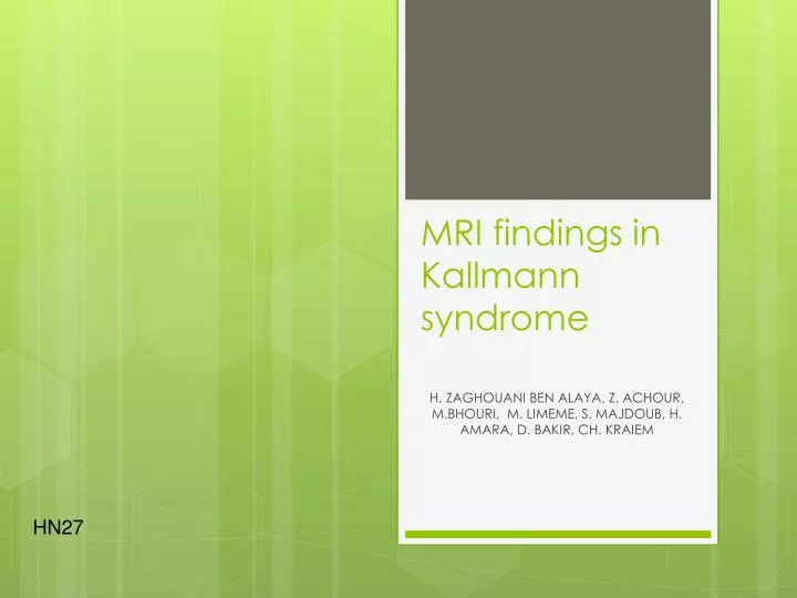 mri findings in kallmann syndrome