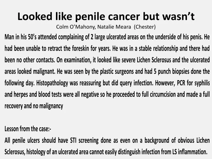 looked like penile cancer but wasn t colm o mahony natalie meara chester