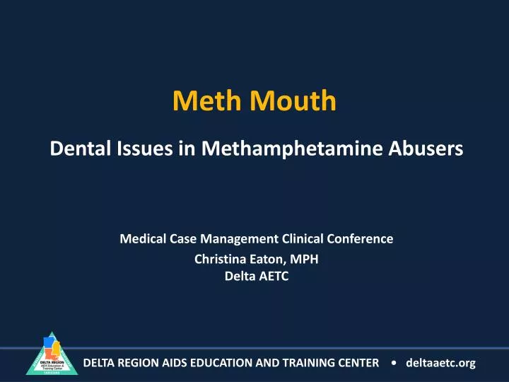 meth mouth