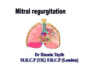 Mitral regurgitation