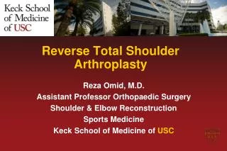 Reverse Total Shoulder Arthroplasty
