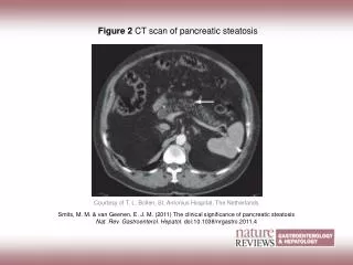 Smits, M. M. &amp; van Geenen, E. J. M. (2011) The clinical significance of pancreatic steatosis