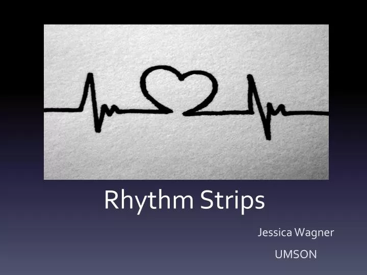 rhythm strips