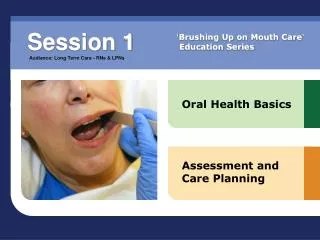 Oral Health Basics