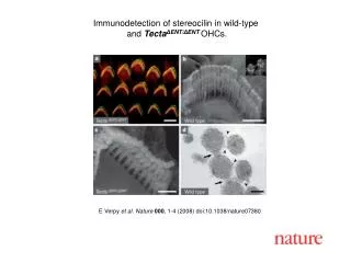 E Verpy et al. Nature 000 , 1-4 (2008) doi:10.1038/nature07380