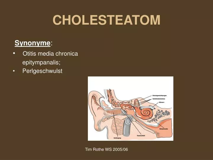 cholesteatom