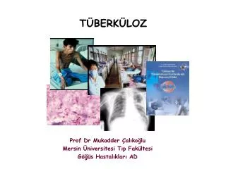t berk loz