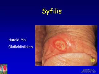 syfilis