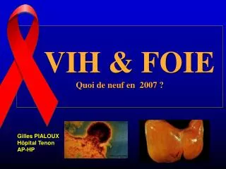 VIH &amp; FOIE Quoi de neuf en 2007 ?