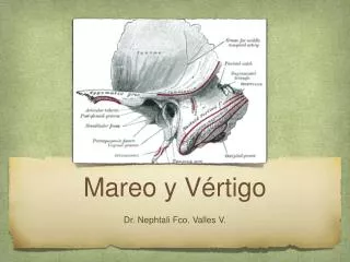 mareo y v rtigo