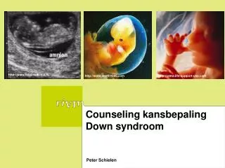 Counseling kansbepaling Down syndroom