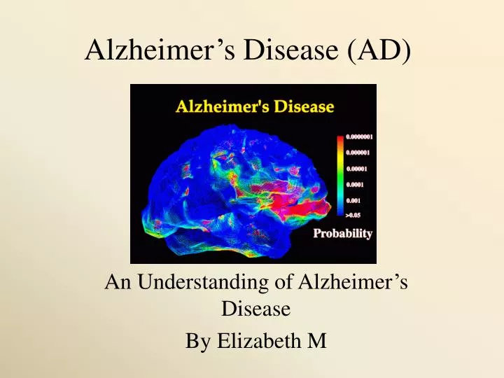 alzheimer s disease ad