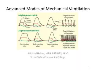 Advanced Modes of Mechanical Ventilation