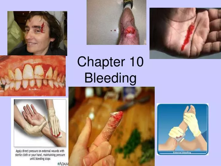 chapter 10 bleeding