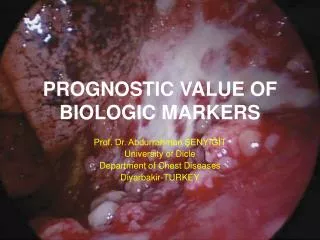 PROGNOSTIC VALUE OF BIOLOGIC MARKERS