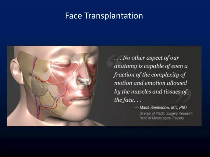 face transplantation