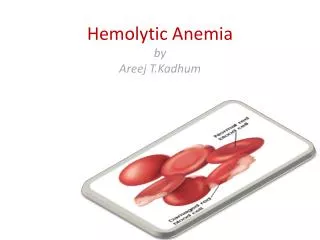 Hemolytic Anemia by Areej T.Kadhum