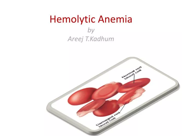 hemolytic anemia by areej t kadhum