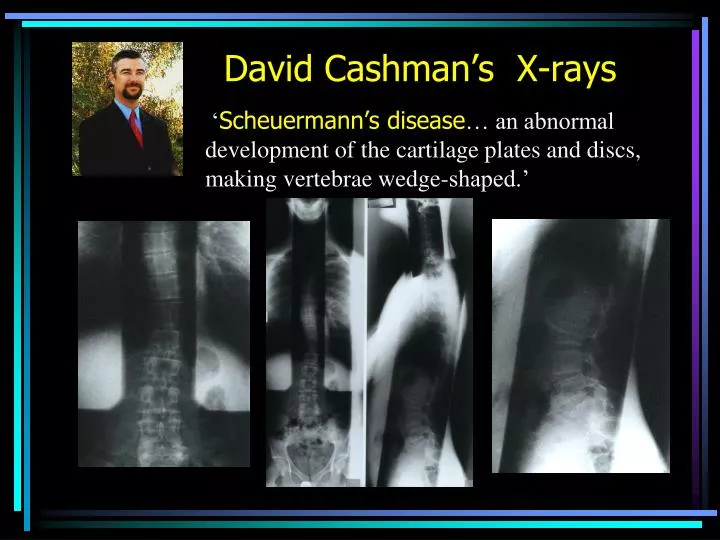 david cashman s x rays