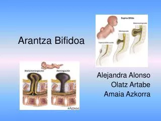 arantza bifidoa