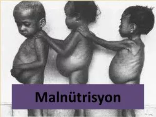 maln trisyon