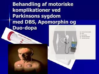 Behandling af motoriske komplikationer ved Parkinsons sygdom med DBS, Apomorphin og Duo- dopa