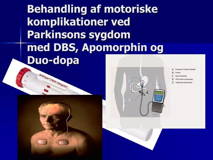 behandling af motoriske komplikationer ved parkinsons sygdom med dbs apomorphin og duo dopa