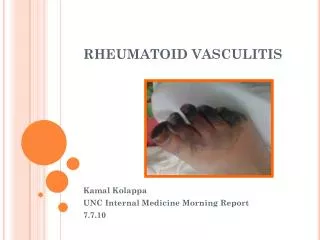 RHEUMATOID VASCULITIS