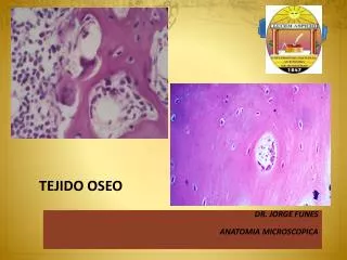 tejido oseo