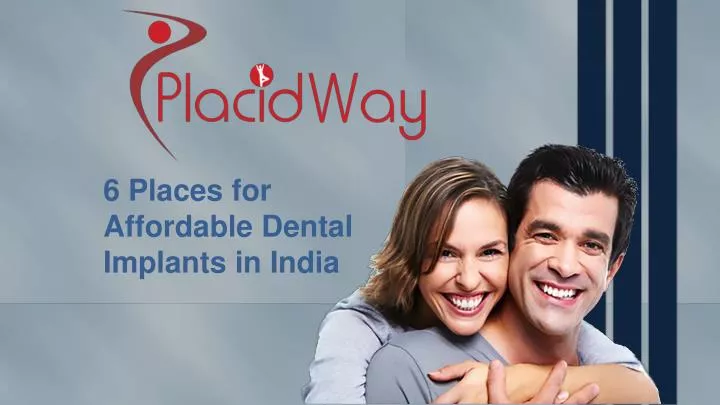 6 places for affordable dental implants in india