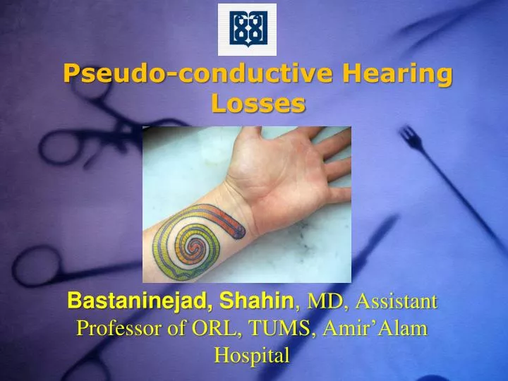 pseudo conductive hearing losses
