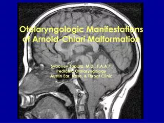 Otolaryngologic Manifestations of Arnold-Chiari Malformation