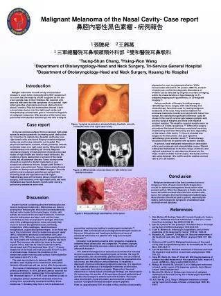 Malignant Melanoma of the Nasal Cavity- Case report ????????? - ????