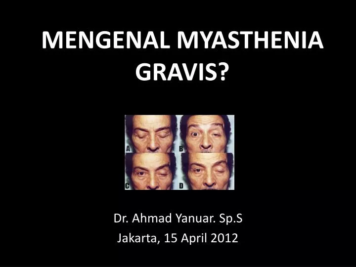 mengenal myasthenia gravis