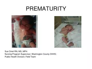 PREMATURITY