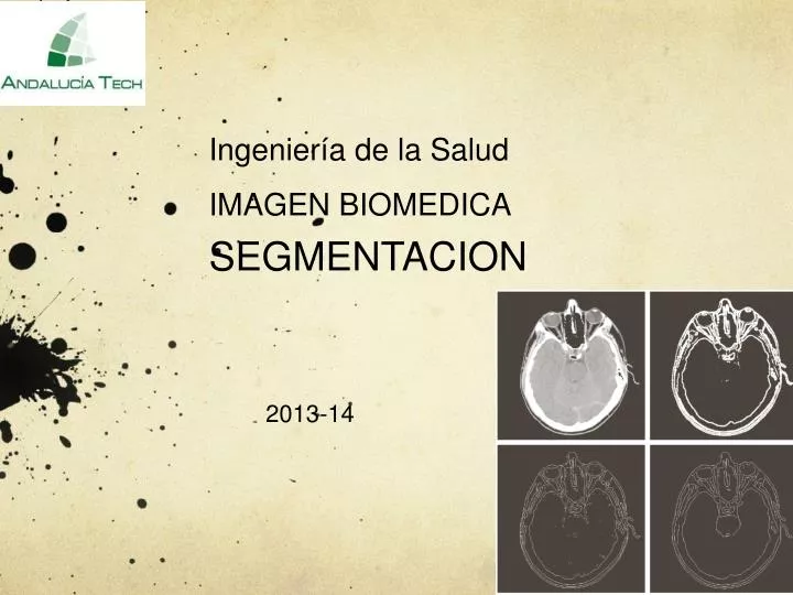 ingenier a de la salud imagen biomedica segmentacion