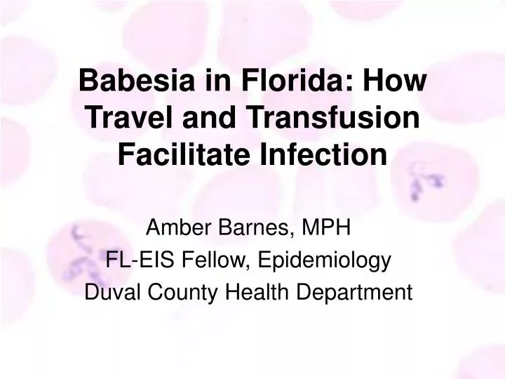babesia in florida how travel and transfusion facilitate infection