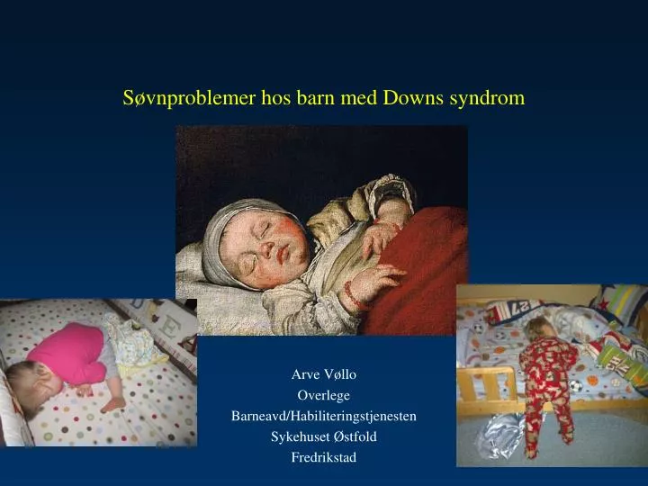 s vnproblemer hos barn med downs syndrom