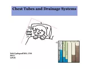 Chest Tubes and Drainage Systems