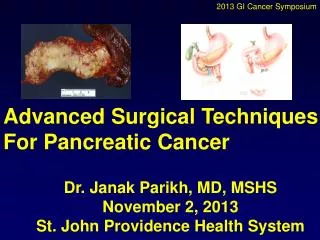 Advanced Surgical Techniques For Pancreatic Cancer
