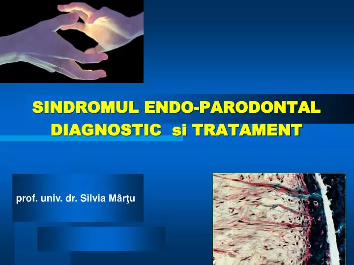 sindromul endo parodontal diagnostic si tratament