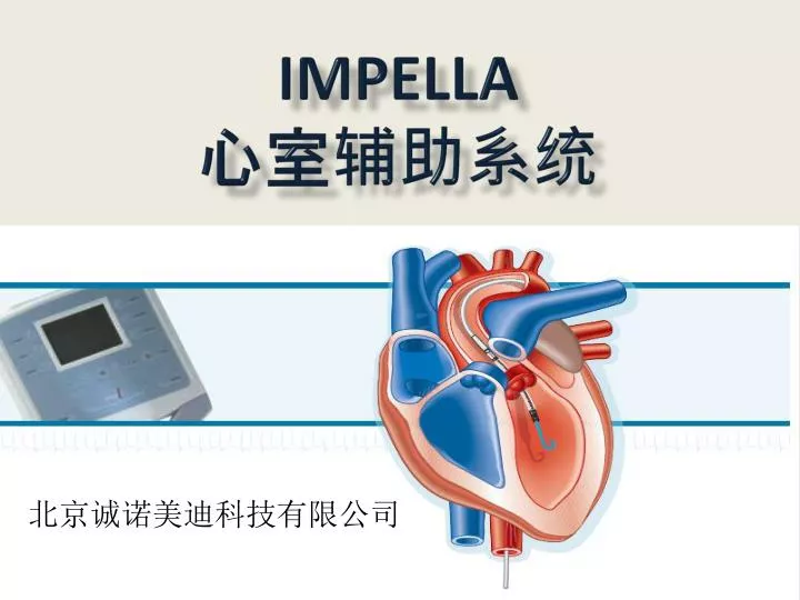 impella