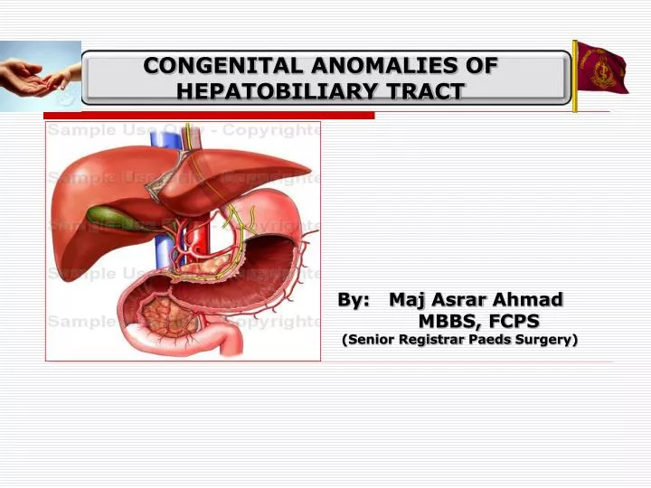 congenital anomalies of hepatobiliary tract