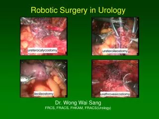Robotic Surgery in Urology Dr. Wong Wai Sang FRCS, FRACS, FHKAM, FRACS(Urology)