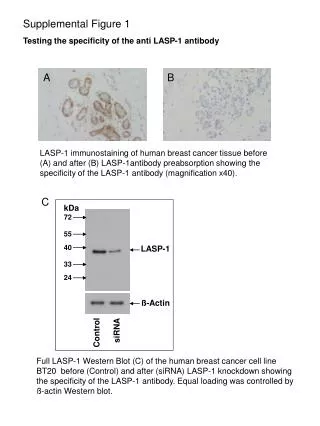 Supplemental Figure 1 Testing the specificity of the anti LASP-1 antibody