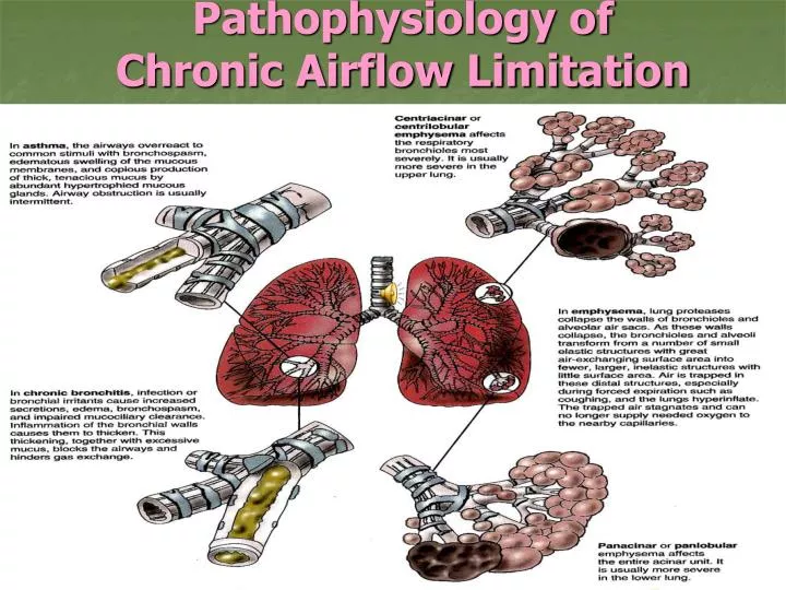 pathophysiology of chronic airflow limitation
