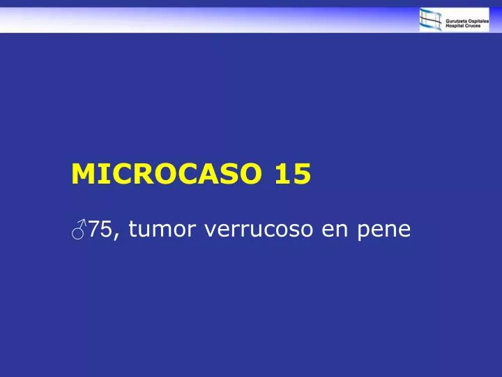 microcaso 15